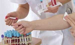 Когда и как пить Дексаметазон при планировании беременности