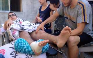 Комплексы упражнений лечебной физкультуры при переломе позвоночника