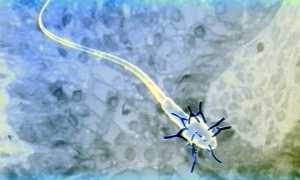 Иммунологическое бесплодие мужчин: крах надежд или есть выход?