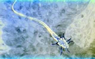 Иммунологическое бесплодие мужчин: крах надежд или есть выход?