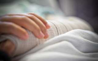 Как лечить и сколько носить гипс при переломе головки лучевой кости