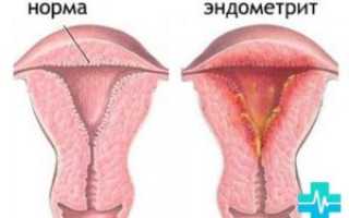 Неприятный запах во время месячных причины