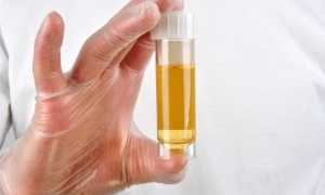 О чем расскажет моча при беременности на ранних сроках