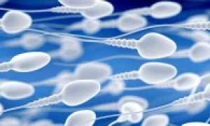 Спермограмма: как сдавать, зачем и о чем расскажут результаты