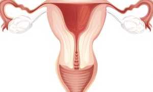 Субинволюция матки: признаки, диагностика и лечение