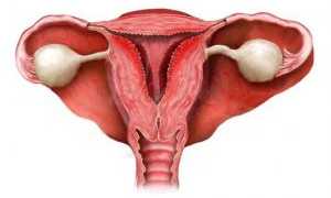 Как подготовиться к ЭКО после эндометрита