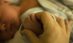 Причины перелома ключицы при родах у новорожденных и последствия травмы