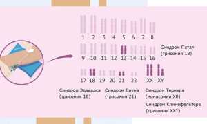 Зачем нужен генетик при планировании беременности