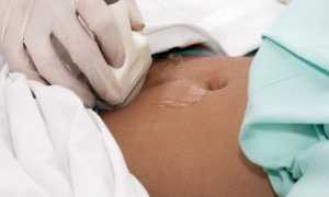 Важное диагностическое обследование мамы — УЗИ после родов: все тонкости проведения процедуры и значения показателей