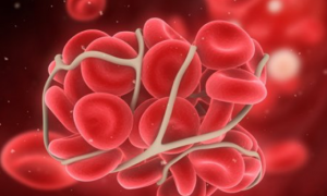 Странные сгустки после родов: симптомы, самопомощь, чистка