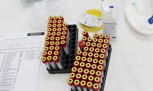 Почему так опасен волчаночный антикоагулянт при беременности