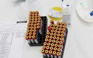 Почему так опасен волчаночный антикоагулянт при беременности