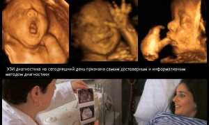 Опасно ли делать УЗИ на ранних сроках беременности