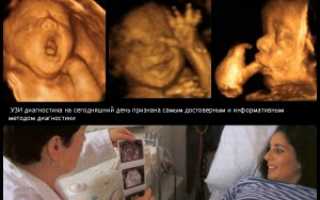 Опасно ли делать УЗИ на ранних сроках беременности