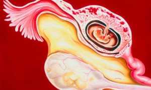 Почему может случиться внематочная беременность при ЭКО?