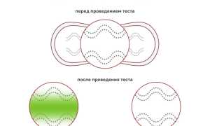 Непредсказуемое подтекание вод: опасность состояния, прогноз