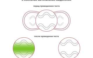 Непредсказуемое подтекание вод: опасность состояния, прогноз