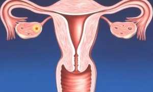 Причины развития эндометрита у молодой мамы