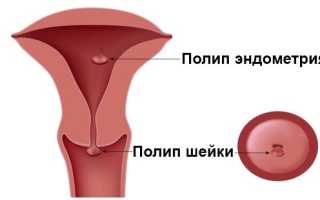 Угроза для жизни матери и ребенка вне зависимости от срока беременности — это акушерские кровотечения