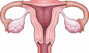 Воспаление матки как осложнение после родов