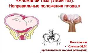 Как выявляют узкий таз при беременности, роды при аномалии