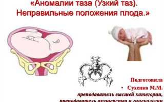 Как выявляют узкий таз при беременности, роды при аномалии