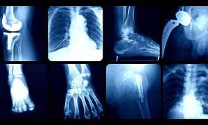 Опасен ли рентген при планировании беременности