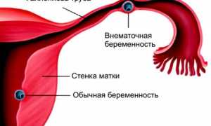 Правильное планирование беременности после беременности