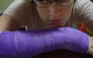 Почему поднимается температура при переломе и как ее вылечить