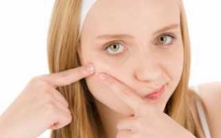 Некрасивые прыщи после родов: причины появления и методы избавления