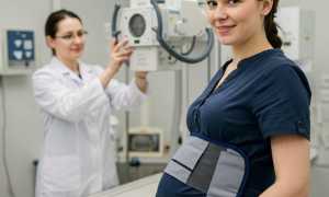 Опасна ли флюорография на ранних сроках беременности?