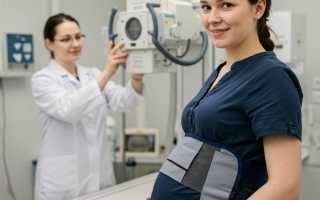 Опасна ли флюорография на ранних сроках беременности?