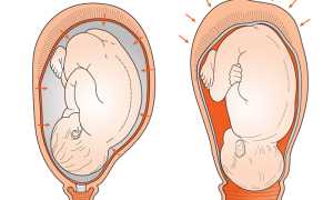 Что такое родовые изгоняющие силы, их влияние на мать и ребенка