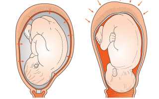 Что такое родовые изгоняющие силы, их влияние на мать и ребенка