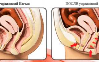 Упражения для восстановления тела после кесарева