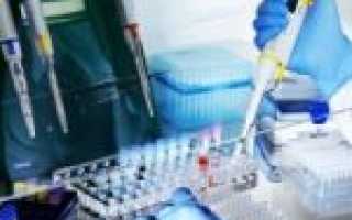 Анализ на тестостерон при планировании беременности, его показатели и результат