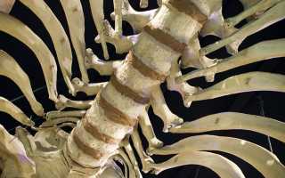 Правила скелетного вытяжения позвоночника при грыже