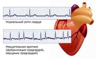 Причины, по которым беспокоит сердце после родов