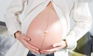 Пигментная полоса после родов: почему появилась и когда пройдет