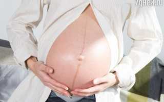 Пигментная полоса после родов: почему появилась и когда пройдет