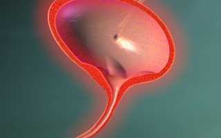 Почему возникает и чем лечится цистит у молодой мамы?