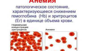 Стоит ли переживать, если после родов кружится голова?