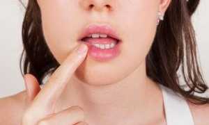 Надо ли переживать, если появился герпес на губах на ранних сроках беременности, и что делать в случае выявления