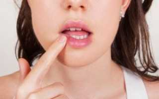 Надо ли переживать, если появился герпес на губах на ранних сроках беременности, и что делать в случае выявления