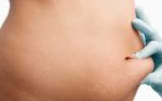 Появилась дряблая кожа после родов: методы борьбы для возвращения красоты и свежести