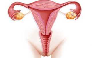 Как восстанавливается матка после кесарева