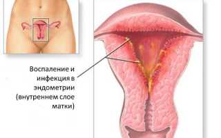 Зачем проводится лапароскопия при бесплодии