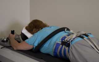 Выбор и правила использования корсета при переломе позвоночника