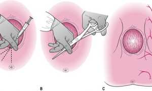 Как, чем и зачем бриться перед родами