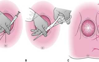 Как, чем и зачем бриться перед родами